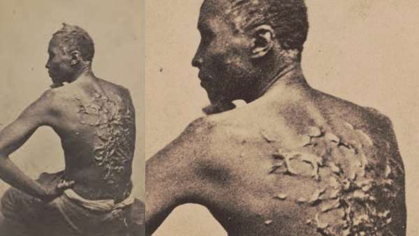 The Scourged Back