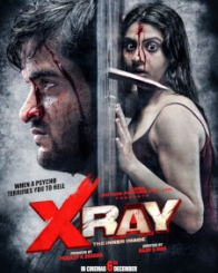 एक्स रे: द इनर इमेज