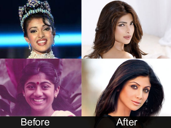 Priyanka Chopra Shilpa Shetty Plastic Surgery Sridevi Cosmetic Surgery Bollywood Actresses Plastic Surgeries Kangana Ranaut Filmibeat bollywood actresses plastic surgeries