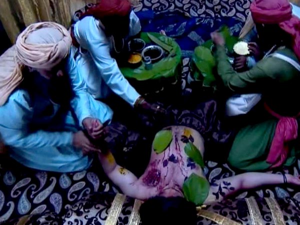 Image result for image of jalal treated by hakim after he was attacked by tiger