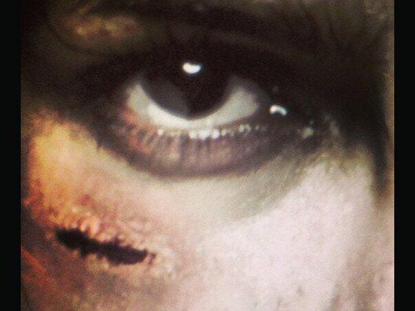 Hurtful Scar