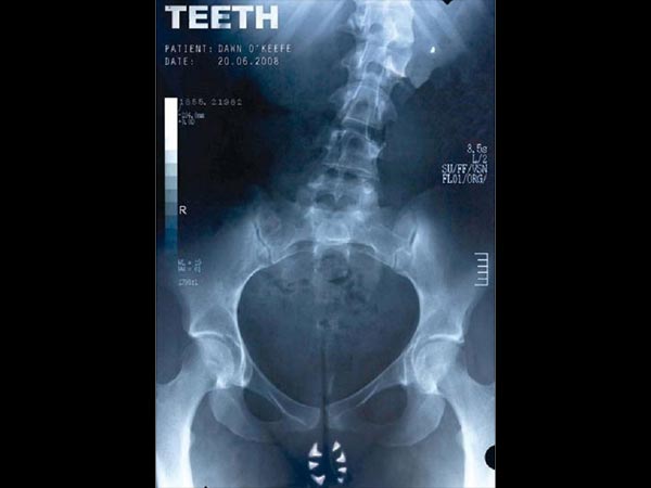 Teeth