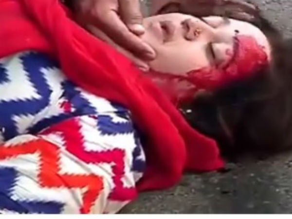 Sarla Hurt Badly