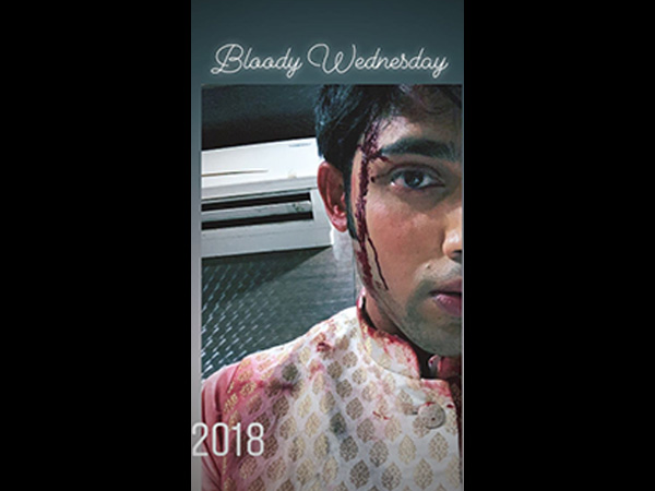 Anurag To Survive
