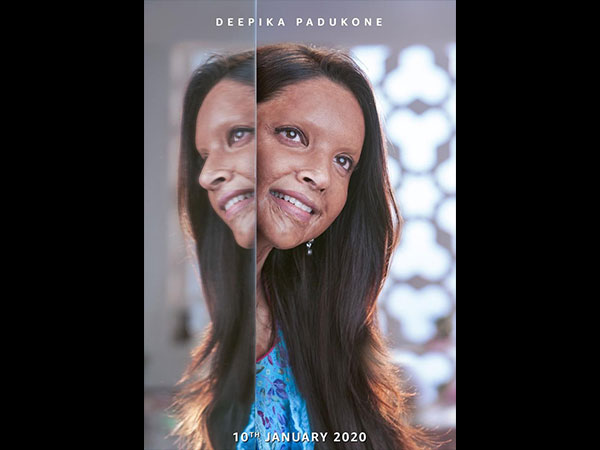 Deepika Reveals Her First Look From Chhapaak