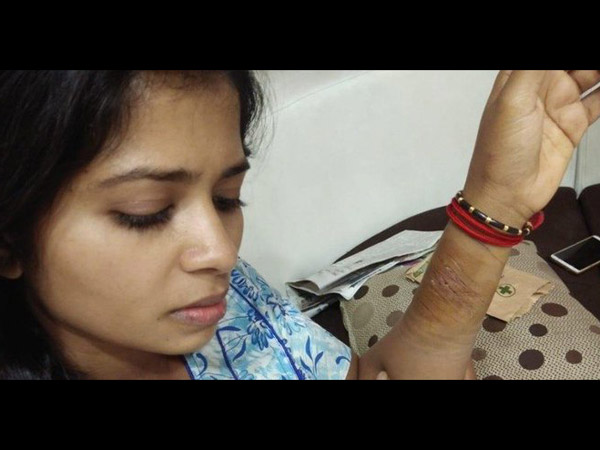 Madhumithas Suicide Attempt At Bigg Boss Tamil 3 House: Pic Goes Viral On Social Media! Madhumithas Suicide Attempt At Bigg Boss Tamil 3 House: Pic Goes Viral On Social Media!