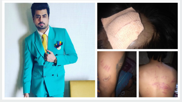 Ex Bigg Boss Pritam Singh Brutally Beaten Up By Goons When He Tried To Save A Woman Ex Bigg Boss Pritam Singh Brutally Beaten Up By Goons When He Tried To Save A Woman