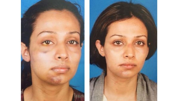 फ्लोरा सैनी फ्लोरा सैनी